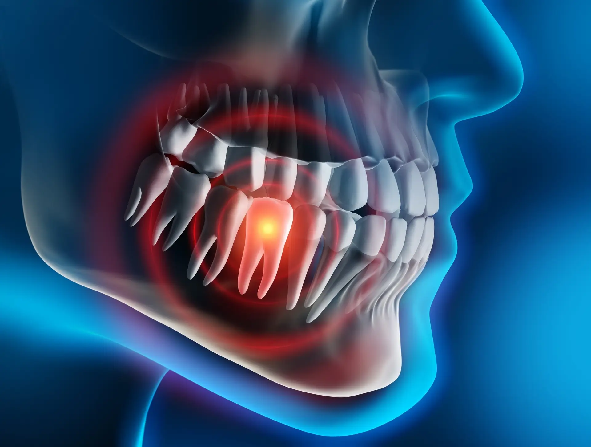Digital model of painful tooth needing an emergency dentist.
